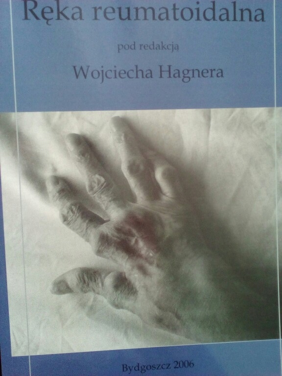 RZS reumatyzm Reka reumatoidalna Hagner