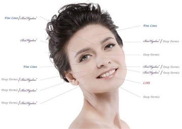 ГИАЛУРОНОВАЯ КИСЛОТА 5мл CROSS-LINED TOP Q DERM 27G!!