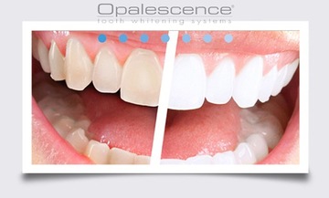 OPALESCENCE PF 1x %16 ОТБЕЛИВАЮЩИЙ ГЕЛЬ ДЛЯ ЗУБОВ США