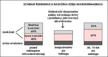 Накладки и головки для алмазной микродермабразии