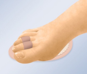 Сломанный КОРРЕКЦИОНЕР HAMMER TOE PAD