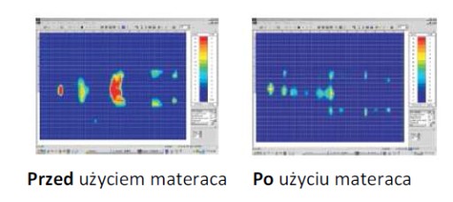 МАТРАС ПРОТИВ-ПРОВОДНИКА Переменное давление